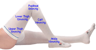 TED Anti-embolism stockings compression chart